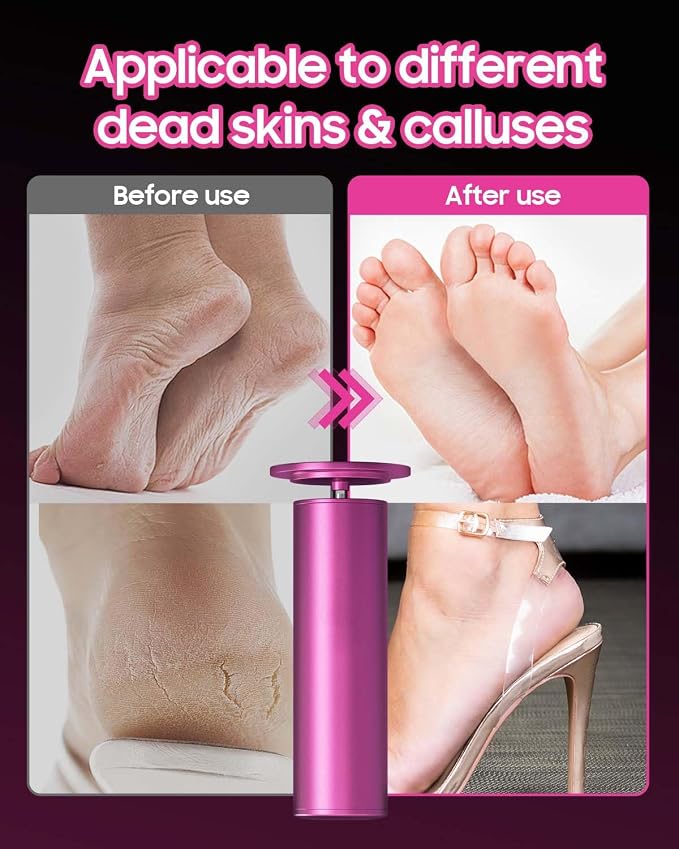 FSA&HSA Electric Foot File - Image 9
