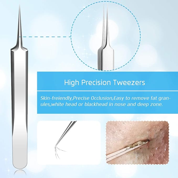 Best Blackhead Remover, Acne Whitehead Removal Kit, Pimple Comedone Extractor - Image 3