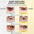 Maskiss Under Eye Patches, Hyaluronic Acid Eye Masks - Image 3