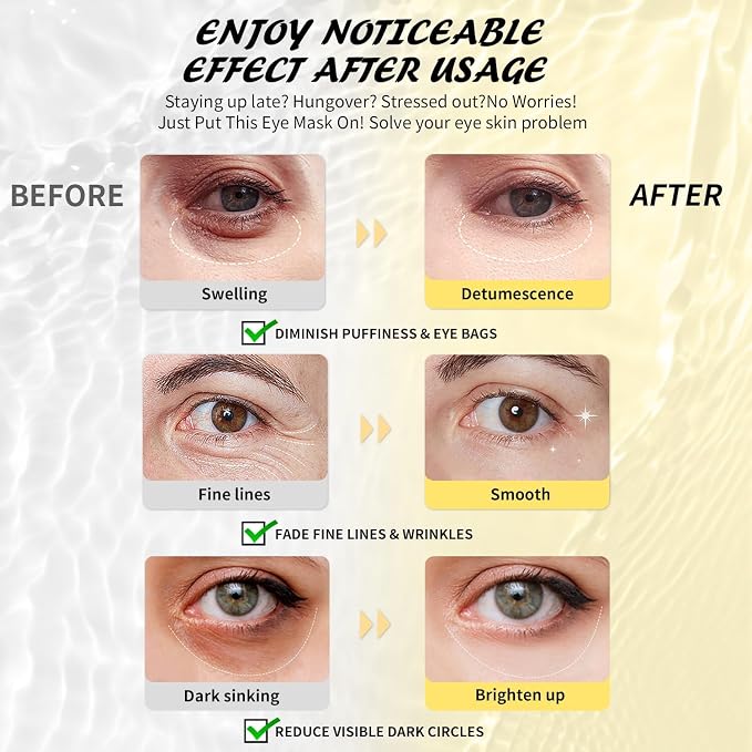 Maskiss Under Eye Patches, Hyaluronic Acid Eye Masks - Image 3