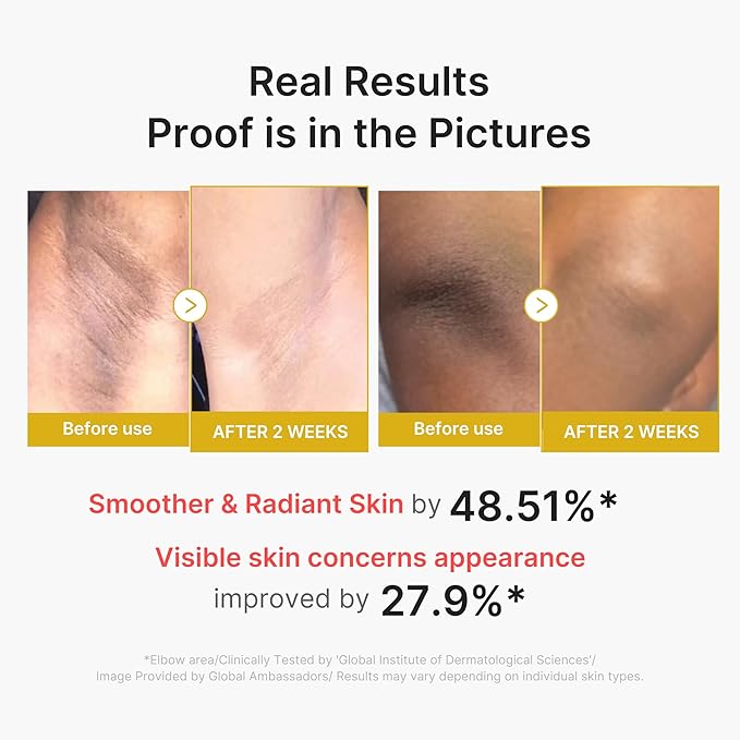 medicube Body Peel Shot with Kojic Acid and Turmeric | Gentle Body Brightening - Image 5