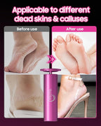 HayZBao Electric Foot Callus Remover - Image 3