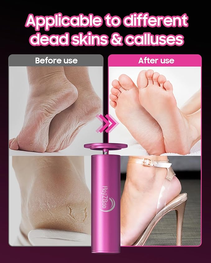 HayZBao Electric Foot Callus Remover - Image 3