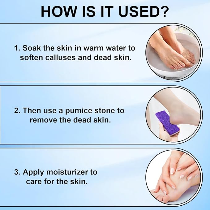Foot Pumice Stone 2 Pack Pedicure Stone - Image 5