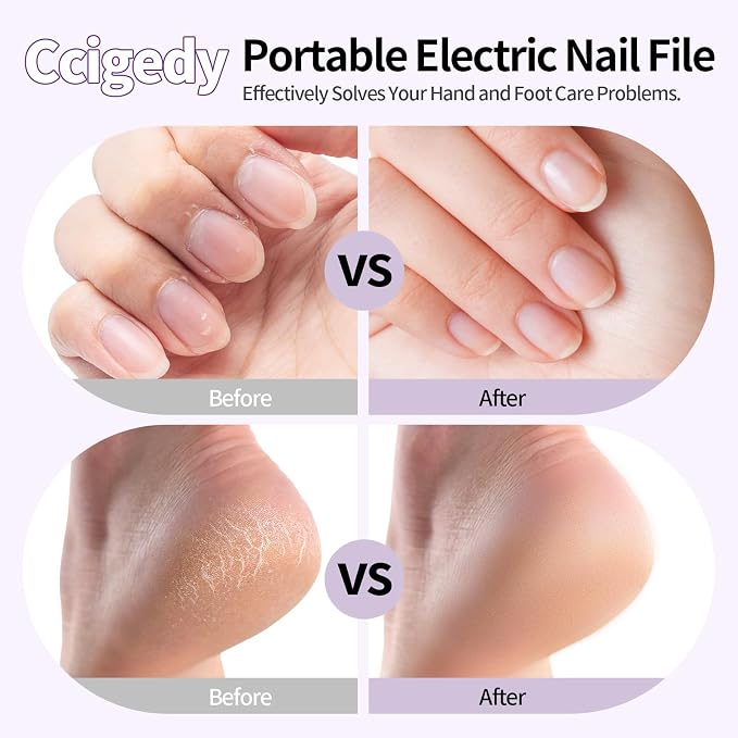 Professional Manicure Pedicure Kit, Cordless Electric Nail File - Image 2
