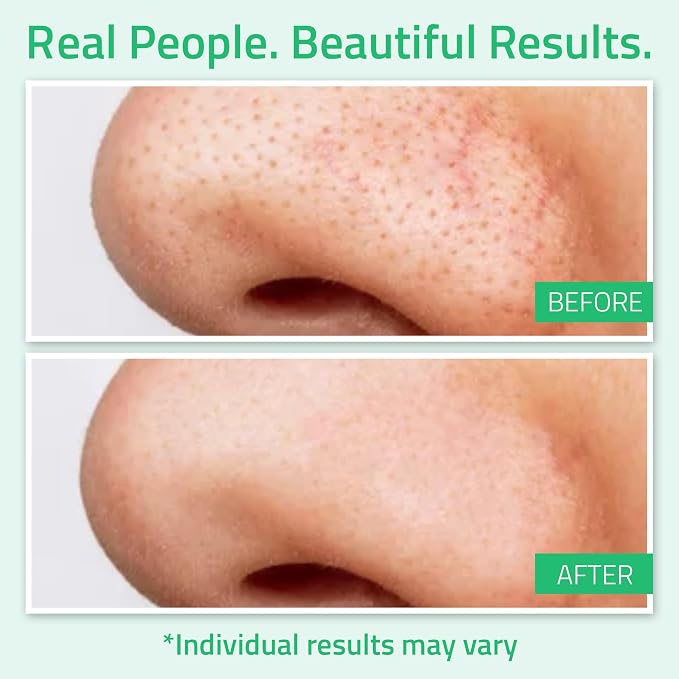 YEOUTH Glycolic Acid Toner for Face 8% - Image 2