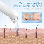 Facial Pore Blackhead Remover Vacuum, 1080P Camera Blackhead Remover, 20x Zoom - Image 5