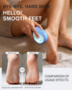 BEZOX Glass Foot File Callus Remover – Professional Foot Scrubber - Image 3