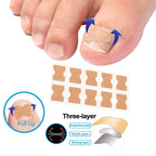 Professional Ingrown Toenail Correction Kit - Image 6
