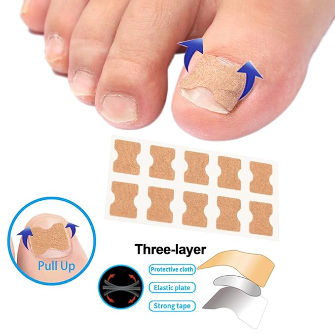 Professional Ingrown Toenail Correction Kit - Image 6