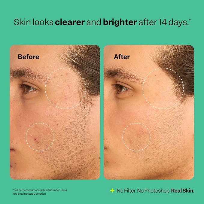 Peach Slices - Snail Rescue Blemish Busting Toner - 95% Snail Mucin Concentrate - Image 6