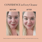 reVive Light Therapy Soniqué Mini Acne Cleanser, Battery-Operated Sonic Face - Image 2