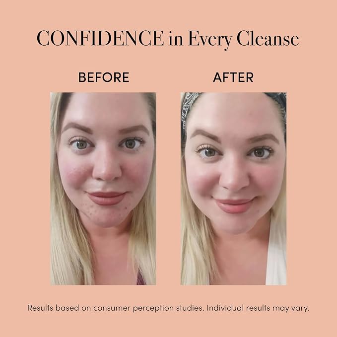 reVive Light Therapy Soniqué Mini Acne Cleanser, Battery-Operated Sonic Face - Image 2