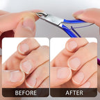 Cuticle Nippers Kit: Precision Nano-Coated Stainless Steel Cuticle Trimmer - Image 3