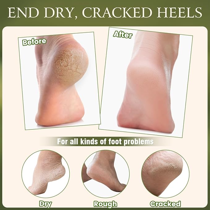 4 Pcs Cracked Heel Repair Set –Comes - Image 4