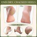 4 Pcs Cracked Heel Repair Set –Comes - Image 4