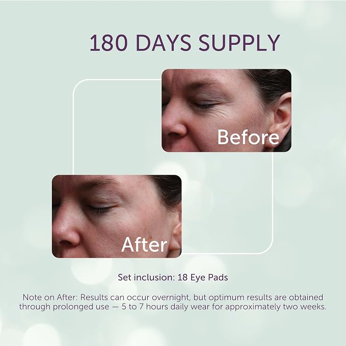 Silc Skin Silicone Eye Pads Reusable Overnight Eye Patches, Medical Grade - Image 3