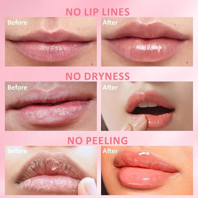 DMSKY 6 PCS Bee Lip Balm Lip Mask Honey Pot, Valentines Day Gifts, Propolis Lip - Image 6