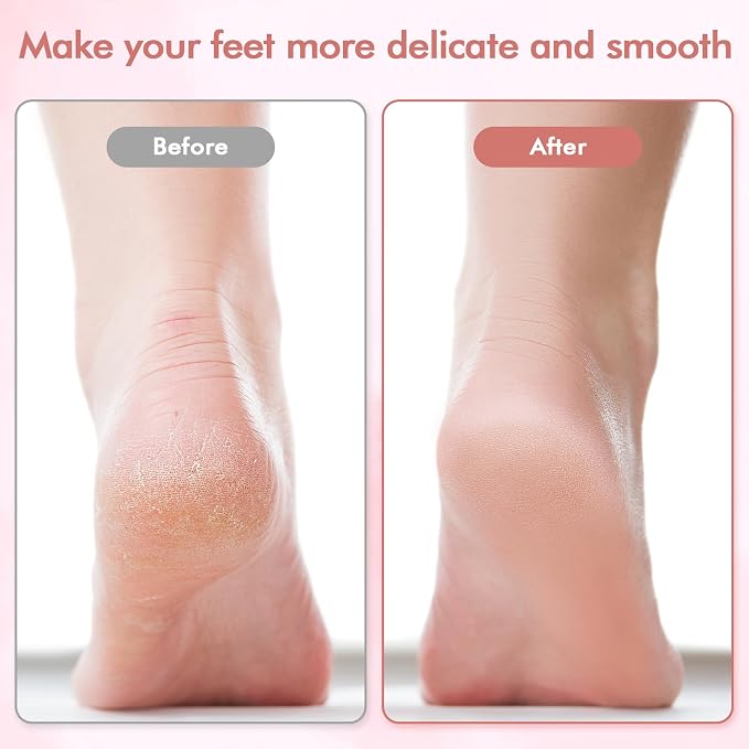 Electric Foot File and Callus Remover, Professional Pedicure Tools - Image 3