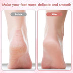 Electric Foot File and Callus Remover, Professional Pedicure Tools - Image 3