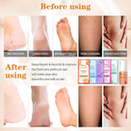 Pedicure Foot Soak Set - Image 3