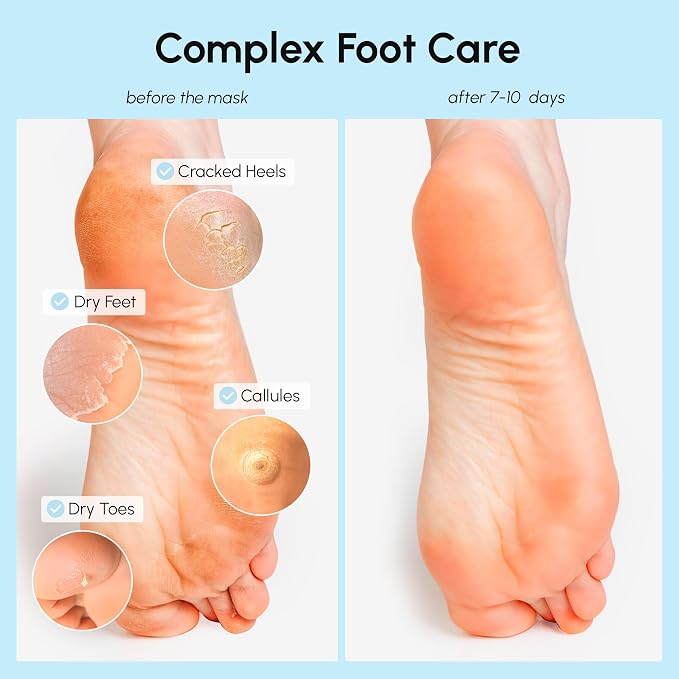 MAREE Foot Peeling Mask – 3-in-1 Foot Mask - Image 3