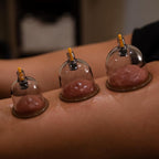 Myofascial Releaser Professional Cupping Therapy Set - Image 9