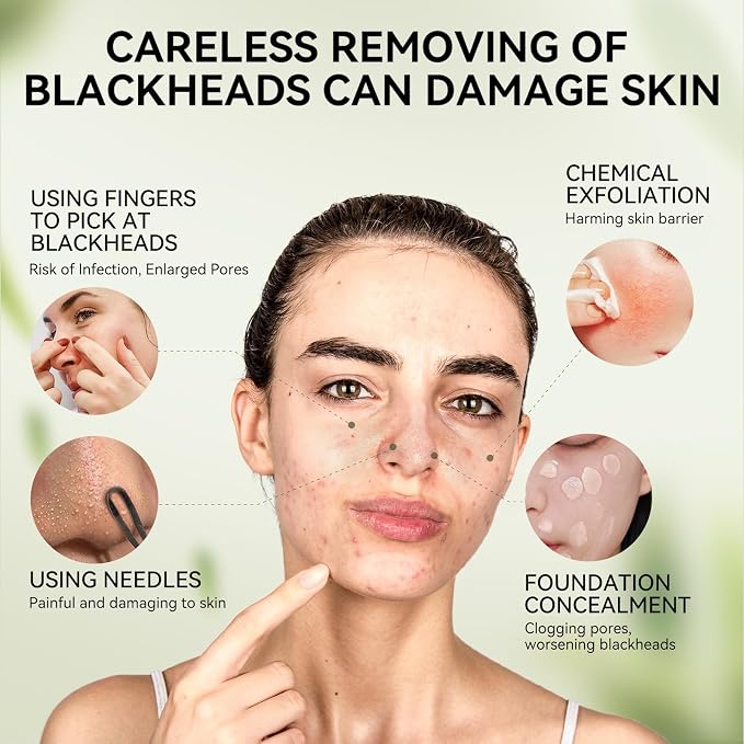 LANBENA Upgraded 2.0 Bamboo Charcoal Blackhead Remover Mask - Image 3