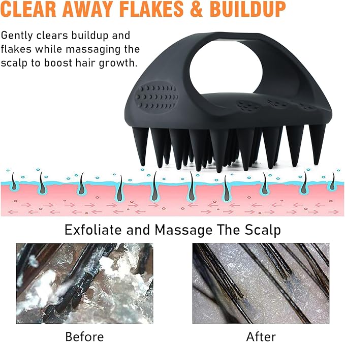 YEALIR Scalp Massager Shampoo Brush, Scalp Scrubber - Image 3