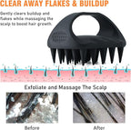 YEALIR Scalp Massager Shampoo Brush, Scalp Scrubber - Image 3