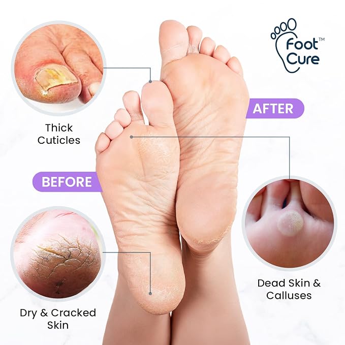 Lavender Foot Soak & Callus Remover Gel Kit - Image 3