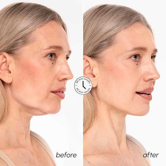 MAREE V Line Lifting Mask with 24K Gold – Deep Collagen Face Mask - Image 4