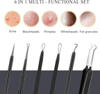 Boxoyx Pimple Popper Tool Kit - Image 2