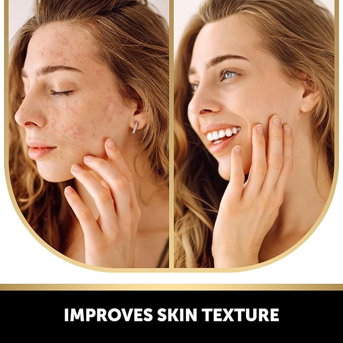 VALITIC Kojic Acid Vitamin C and Retinol Soap Bars - Image 3