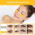 Qyiywim Under Eye Patches 70PCS, 24K Gold Eye Patches - Image 6