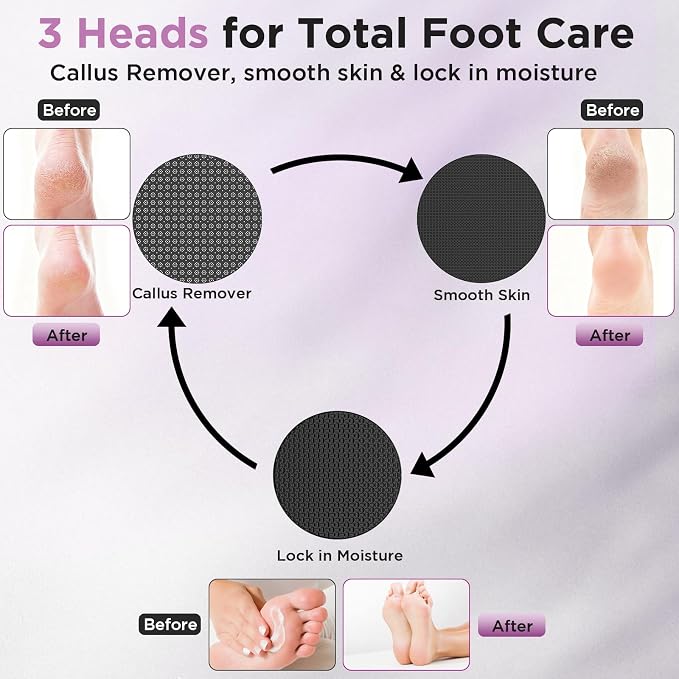 Electric Foot Callus Remover, Apply Oil, Foot SPA, Foot File, Reusable - Image 3