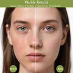 Real Perfection Gua Sha Facial Tools Face Roller - Image 4