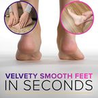 RUSTPROOF Foot File Callus Remover - Image 8