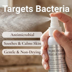 Pure Relief Rescue Spray for Sensitive, Irritated & Blemish-Prone Skin – - Image 4