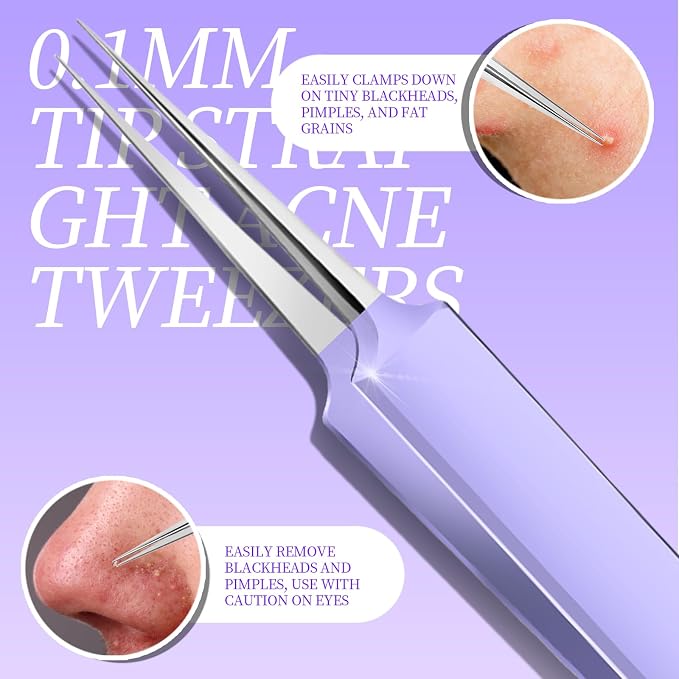 Teenitor Pimple Popper Tool Kit and Blackhead Remover Tools, Ingrown Hair - Image 4