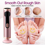 Electric Foot Callus Remover Rechargeable, Professional Pedicure Tools - Image 6