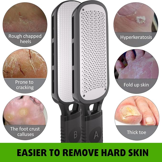 Antonki Foot File for Dead Skin, Double Sided Callus Remover for Feet, Metal - Image 5