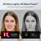Ulike ReGlow LED Face Mask, Remote Control, Eye Protection, Home Skincare Device - Image 3
