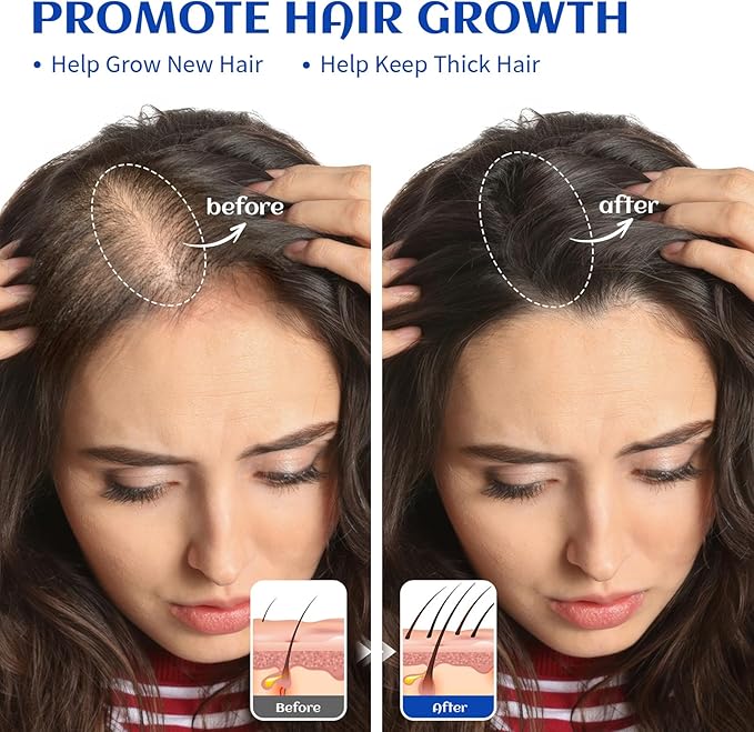 HIQILI Rosemary Oil for Hair Growth, 100% Pure Natural, Add to Shampoo & - Image 2