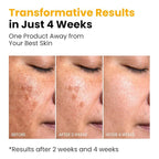 QUIA Turmeric + Kojic Acid Overnight Wrapping Mask – Hydration Mask - Image 5