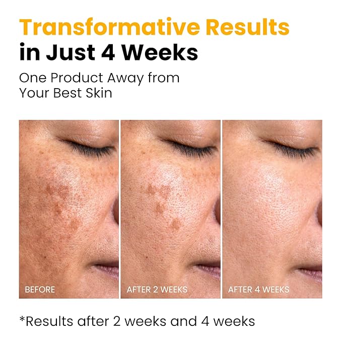 QUIA Turmeric + Kojic Acid Overnight Wrapping Mask – Hydration Mask - Image 5