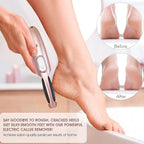 Powerful Electric Callus Remover Wand – Rechargeable Foot File, Grinder & - Image 4