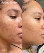 Topicals Faded Brightening and Clearing Serum | Reduces Discoloration, - Image 6