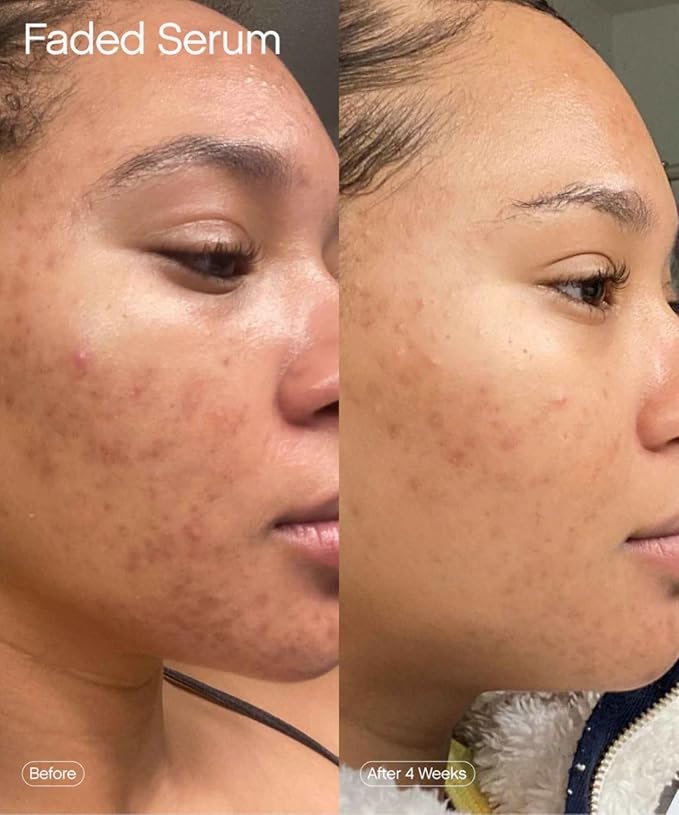 Topicals Faded Brightening and Clearing Serum | Reduces Discoloration, - Image 6