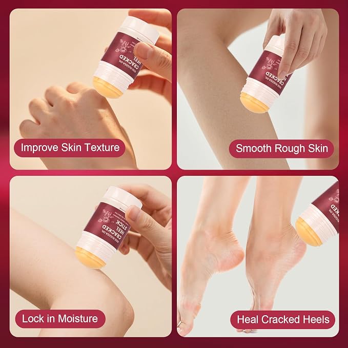TEAWOO 2 Pcs Cracked Heel Treatment & Repair Stick Set – Rose Oil Infused - Image 4